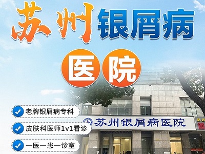 苏州治疗头部银屑病好的医院